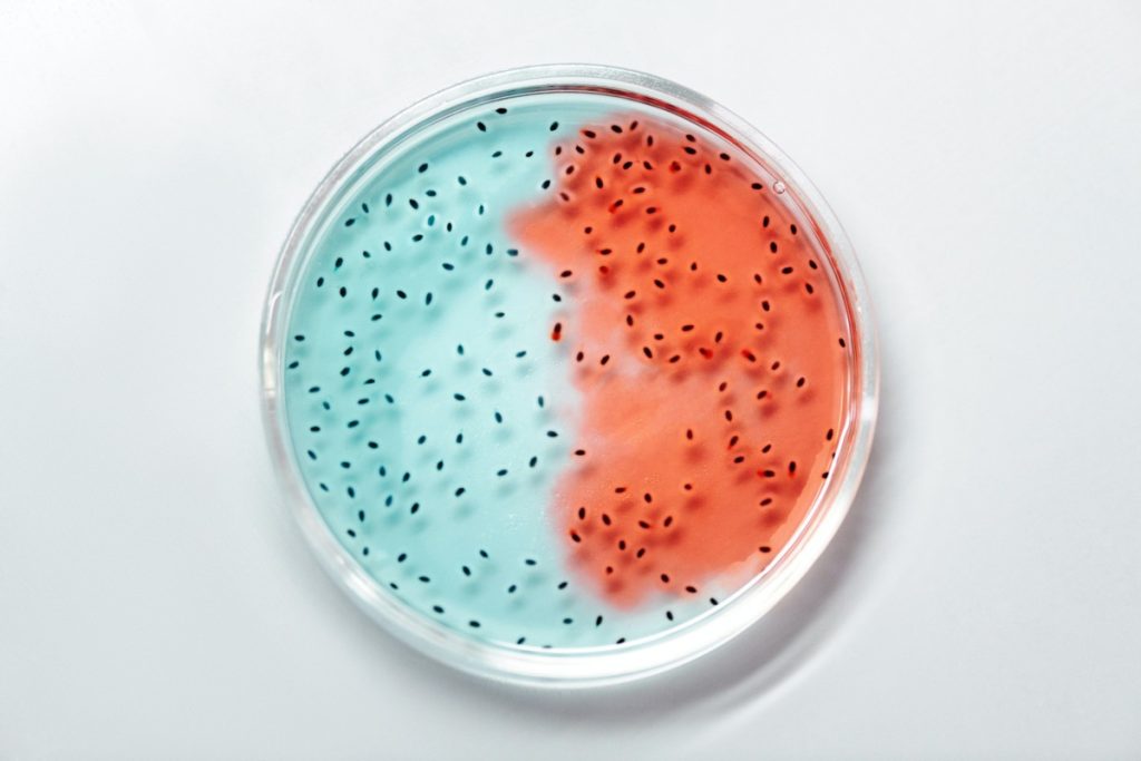 Zuccheri aggiunti e dolcificanti modellano il microbiota intestinale